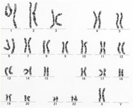 染色体核型の見本