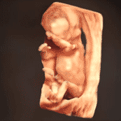 ムービー：3D/4Dエコー(妊娠12週の胎児)